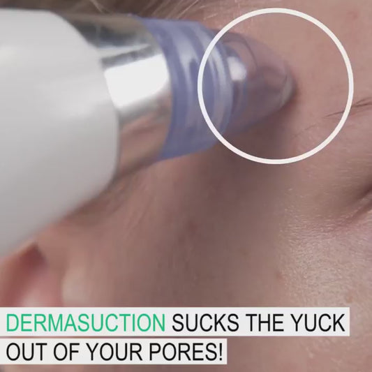 Blackhead Suction Remover & Pore Vacuum | Ultimate Beauty Tool for Deep Pore Cleaning | Cell Operated